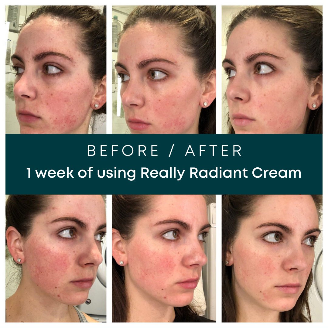 REALLY RADIANT CREAM - 35 Thousand