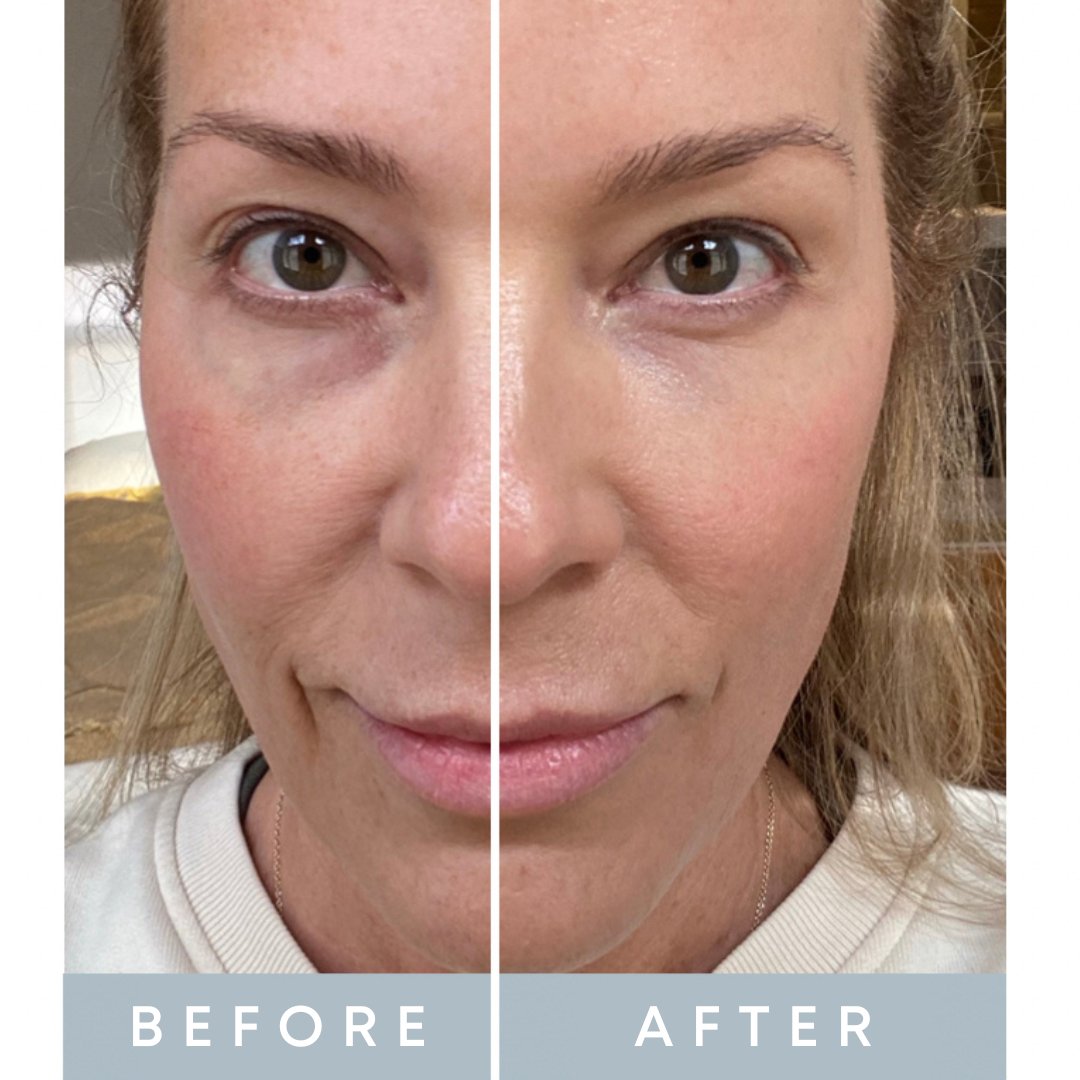 35 Thousand All In Day Serum SPF30 Hydrate Perfect Protect 35-thousand-all-in-day-serum-spf30-hydrate-perfect-protect